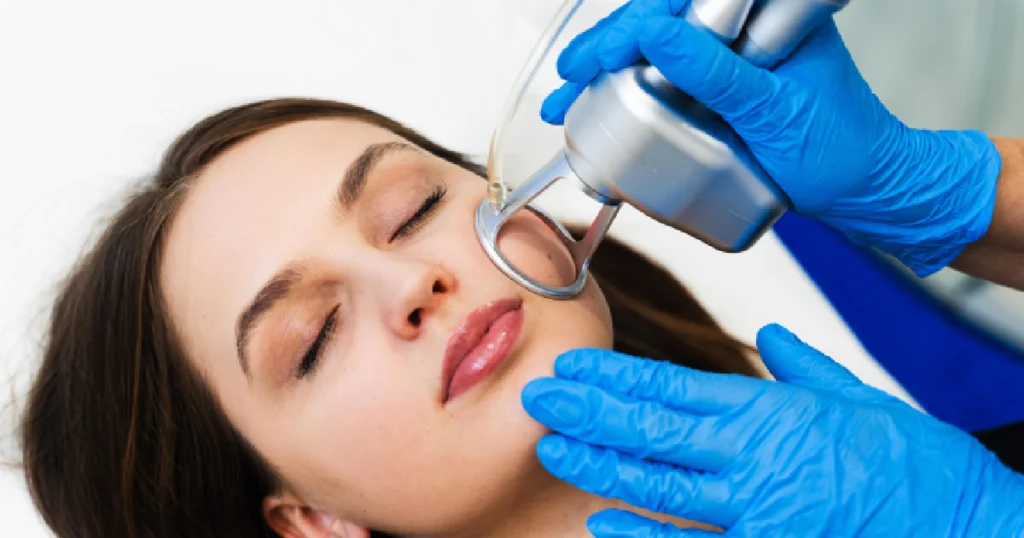 Woman receiving Tetra CO2 laser treatment on cheek in Manchester, NH