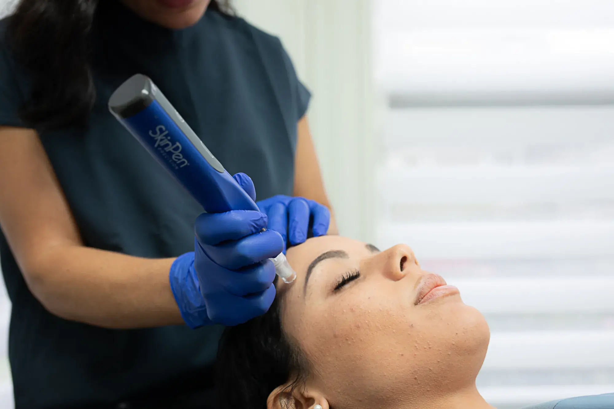 Skinpen Microneedling in Manchester, NH at The Alchemy Clinic