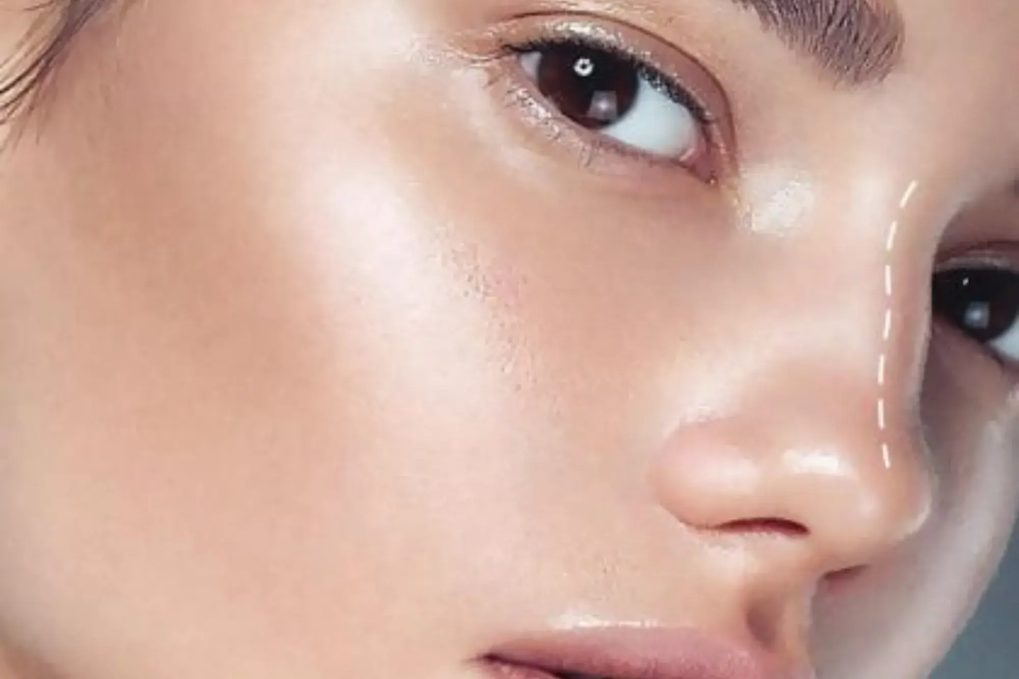 Injectable treatment results with The Alchemy Clinic in Manchester, NH