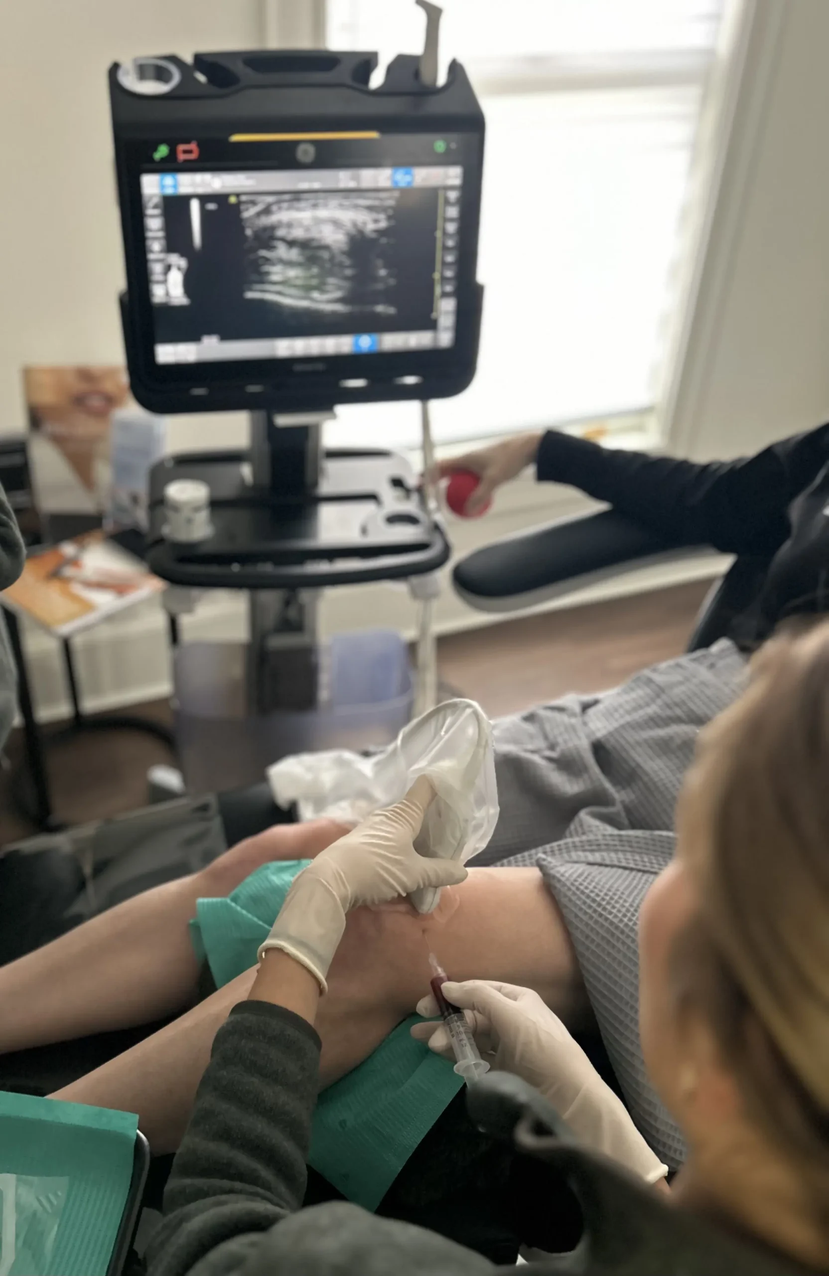 PRP/PRF treatment at The Alchemy Clinic in Manchester, NH