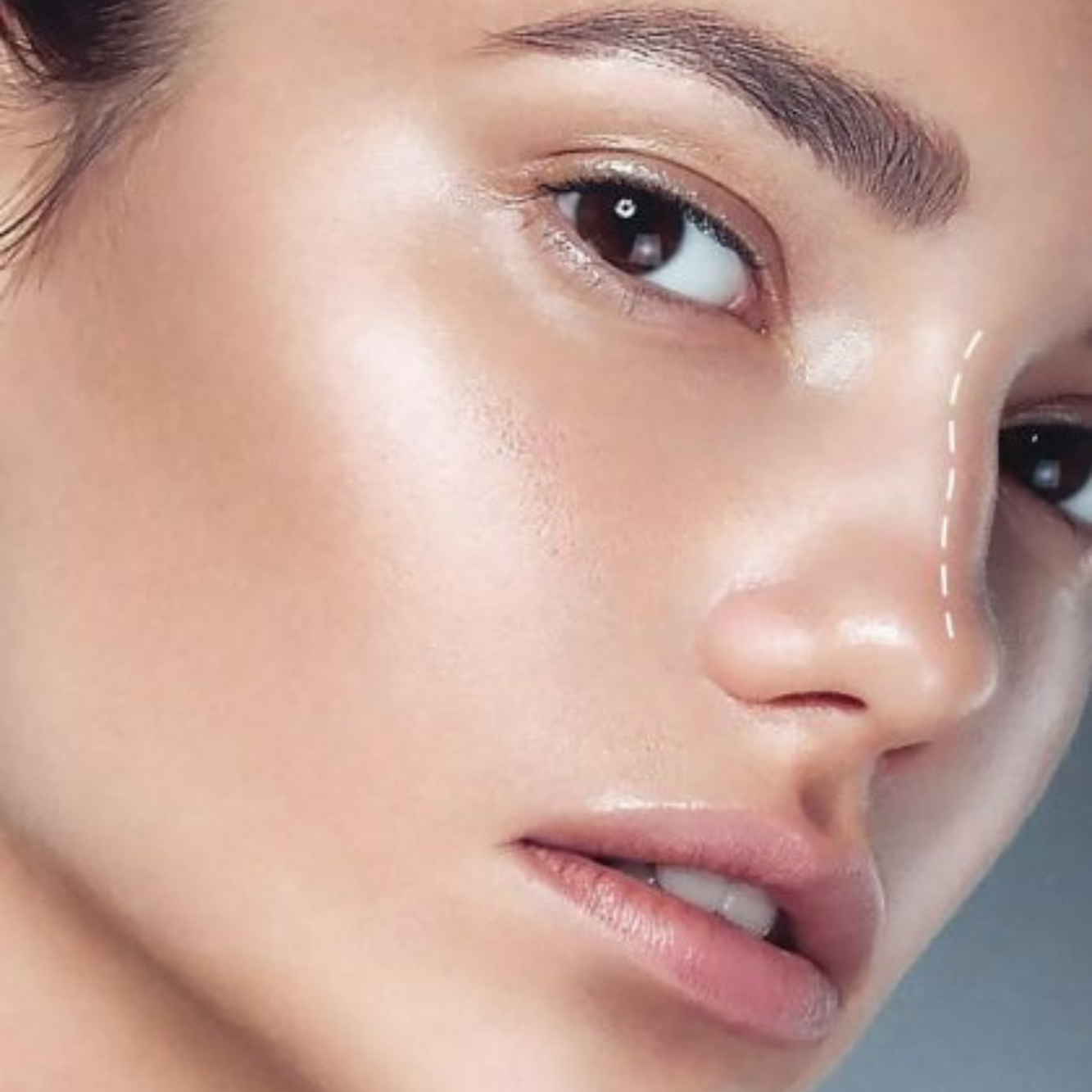Non Surgical Rhinoplasty Manchester, NH at The Alchemy Clinic