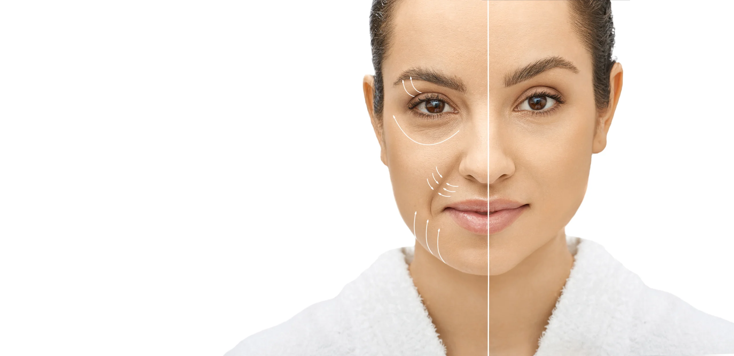 Before and After Chemical Peels In Manchester, NH at The Alchemy Clinic