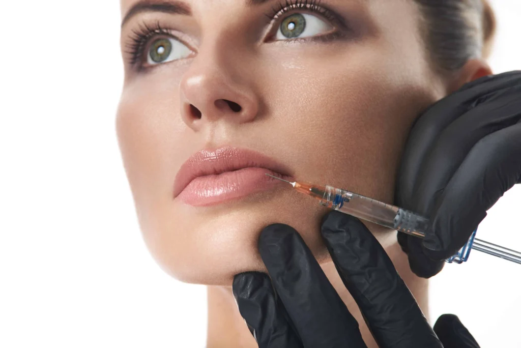 Lip Filler Correction