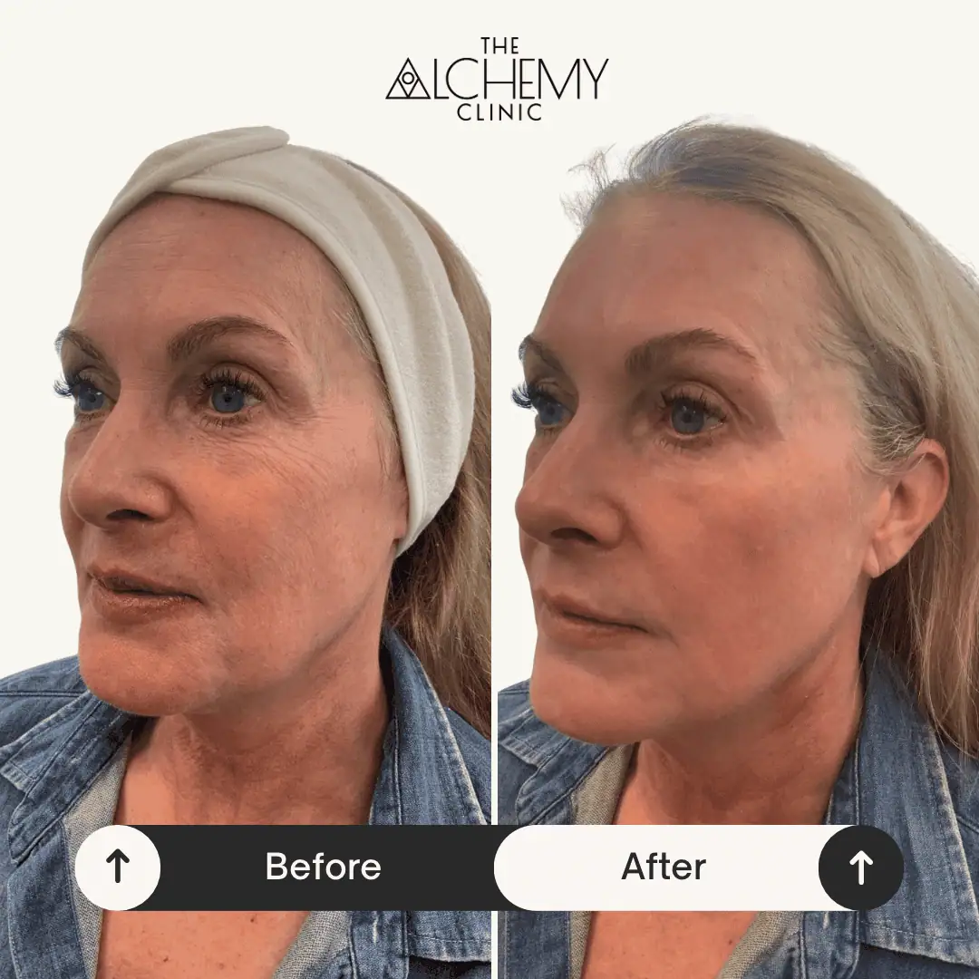 Beige Minimalist Skincare Before and After Instagram