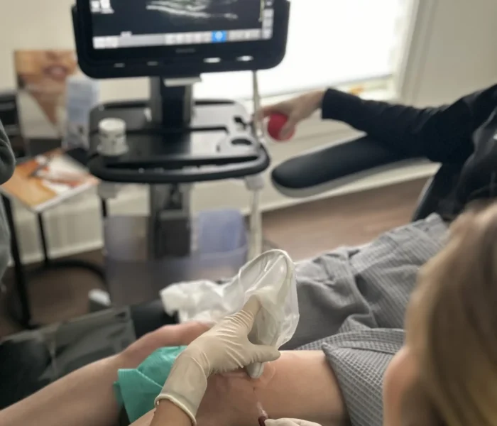 PRP/PRF treatment at The Alchemy Clinic in Manchester, NH