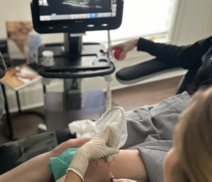 PRP/PRF treatment at The Alchemy Clinic in Manchester, NH