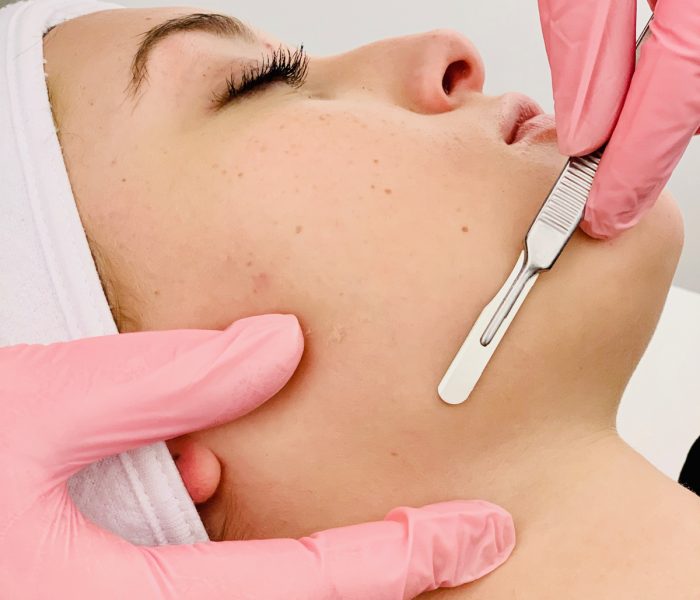 Dermaplaning in Manchester, NH at The Alchemy Clinic