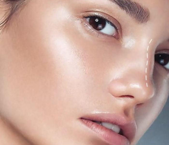 Non Surgical Rhinoplasty Manchester, NH at The Alchemy Clinic